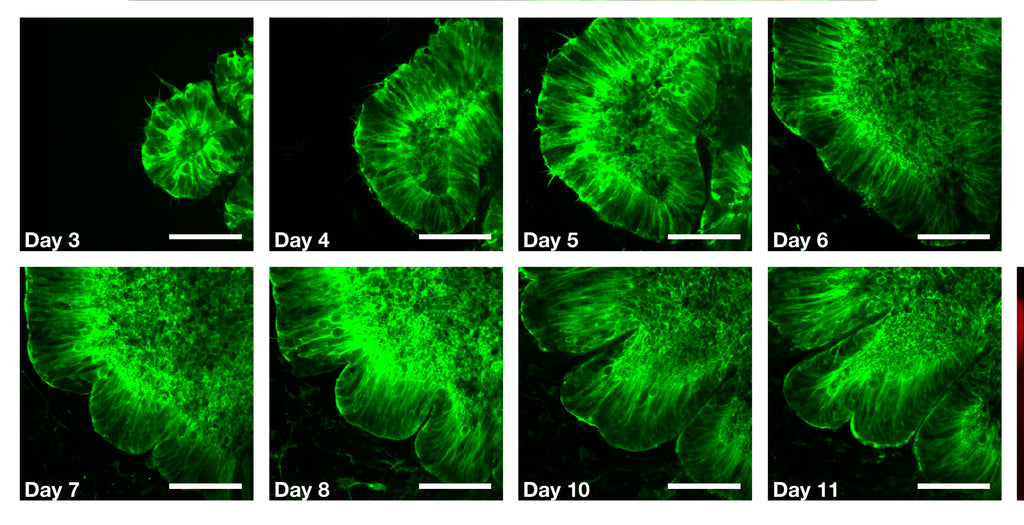 Lab-Created Test Tube Brains Help Scientists Understand the Onset of Congenital Diseases